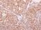 IFI30 Lysosomal Thiol Reductase antibody, PA5-21533, Invitrogen Antibodies, Immunohistochemistry paraffin image 