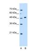 Glycosyltransferase Like Domain Containing 1 antibody, NBP1-53078, Novus Biologicals, Western Blot image 