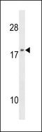 NME/NM23 Nucleoside Diphosphate Kinase 1 antibody, LS-C101172, Lifespan Biosciences, Western Blot image 