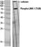 LIM Domain Kinase 1 antibody, STJ90321, St John