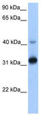 Trans-2,3-Enoyl-CoA Reductase antibody, TA346653, Origene, Western Blot image 