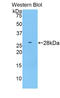 ADAM Metallopeptidase Domain 15 antibody, LS-C292557, Lifespan Biosciences, Western Blot image 