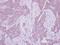 CDK5 Regulatory Subunit Associated Protein 1 antibody, NBP2-15844, Novus Biologicals, Immunohistochemistry frozen image 