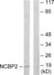 Nuclear cap-binding protein subunit 2 antibody, abx013522, Abbexa, Western Blot image 