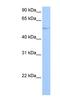 G Protein-Coupled Receptor Kinase 4 antibody, NBP1-55313, Novus Biologicals, Western Blot image 