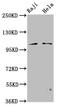 Phosphofurin Acidic Cluster Sorting Protein 1 antibody, LS-C680993, Lifespan Biosciences, Western Blot image 