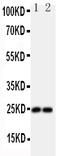 Fibroblast Growth Factor 19 antibody, LS-C312635, Lifespan Biosciences, Western Blot image 