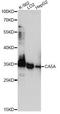 Carbonic Anhydrase 5A antibody, A14709, ABclonal Technology, Western Blot image 