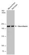 Neurofascin antibody, GTX133274, GeneTex, Western Blot image 