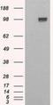 Ectonucleotide Pyrophosphatase/Phosphodiesterase 1 antibody, NBP2-27561, Novus Biologicals, Western Blot image 