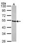 Purinergic Receptor P2X 5 antibody, NBP2-19658, Novus Biologicals, Western Blot image 