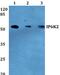 Inositol Hexakisphosphate Kinase 2 antibody, PA5-75344, Invitrogen Antibodies, Western Blot image 