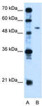 Pregnancy Specific Beta-1-Glycoprotein 1 antibody, TA346442, Origene, Western Blot image 