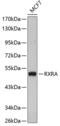 Retinoid X Receptor Alpha antibody, 19-036, ProSci, Western Blot image 