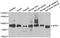 Acylaminoacyl-Peptide Hydrolase antibody, A5893, ABclonal Technology, Western Blot image 