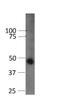 Glycogen Synthase Kinase 3 Beta antibody, NBP1-47470, Novus Biologicals, Western Blot image 