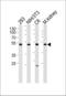 Cyclin Dependent Kinase 9 antibody, LS-C164338, Lifespan Biosciences, Western Blot image 