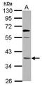 Oxidoreductase NAD Binding Domain Containing 1 antibody, GTX122564, GeneTex, Western Blot image 