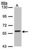 Flavin Containing Dimethylaniline Monoxygenase 3 antibody, PA5-27916, Invitrogen Antibodies, Western Blot image 
