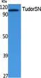 Staphylococcal Nuclease And Tudor Domain Containing 1 antibody, A02602, Boster Biological Technology, Western Blot image 