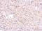 Glutathione S-Transferase Pi 1 antibody, NBP2-16757, Novus Biologicals, Immunohistochemistry paraffin image 