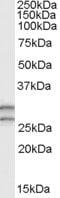 Catechol-O-Methyltransferase antibody, NB100-1780, Novus Biologicals, Western Blot image 