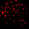 Interleukin-1 receptor-associated kinase-like 2 antibody, 2213, ProSci, Immunofluorescence image 