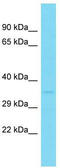 Glycerophosphodiester phosphodiesterase domain-containing protein 1 antibody, TA331543, Origene, Western Blot image 