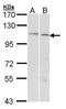 Glucosidase II Alpha Subunit antibody, TA308533, Origene, Western Blot image 
