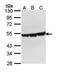 ATP Binding Cassette Subfamily B Member 11 antibody, orb13275, Biorbyt, Western Blot image 