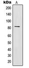 Interleukin-31 receptor subunit alpha antibody, MBS820833, MyBioSource, Western Blot image 