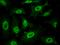 Estrogen Receptor 2 antibody, 100226-MM09, Sino Biological, Immunohistochemistry paraffin image 