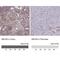 ATP Binding Cassette Subfamily A Member 8 antibody, NBP1-91641, Novus Biologicals, Immunohistochemistry paraffin image 