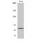 Ezrin antibody, LS-C383435, Lifespan Biosciences, Western Blot image 