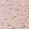 Matrix Gla Protein antibody, LS-C667897, Lifespan Biosciences, Immunohistochemistry paraffin image 