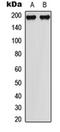 Mitogen-Activated Protein Kinase Kinase Kinase 1 antibody, orb256669, Biorbyt, Western Blot image 