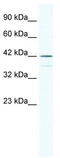 Transcription factor SOX-3 antibody, TA333938, Origene, Western Blot image 
