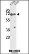 FKBP Prolyl Isomerase 10 antibody, 62-870, ProSci, Western Blot image 