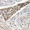 Fizzy And Cell Division Cycle 20 Related 1 antibody, A03219-1, Boster Biological Technology, Immunohistochemistry paraffin image 