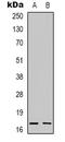 Ribosomal Protein S13 antibody, LS-C368688, Lifespan Biosciences, Western Blot image 