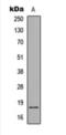 Synuclein Alpha antibody, orb393167, Biorbyt, Western Blot image 