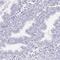 HDGF Like 1 antibody, HPA063707, Atlas Antibodies, Immunohistochemistry frozen image 