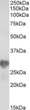 Nicotinamide N-Methyltransferase antibody, STJ73101, St John