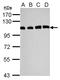 Ubiquitin Specific Peptidase 13 antibody, LS-C155554, Lifespan Biosciences, Western Blot image 