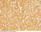 Serpin Family D Member 1 antibody, 10295-R008, Sino Biological, Immunohistochemistry paraffin image 