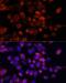 GLI Family Zinc Finger 1 antibody, LS-C749662, Lifespan Biosciences, Immunofluorescence image 