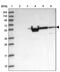 AlkB Homolog 8, TRNA Methyltransferase antibody, PA5-58517, Invitrogen Antibodies, Western Blot image 