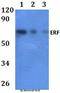 ETS2 Repressor Factor antibody, A03411-2, Boster Biological Technology, Western Blot image 