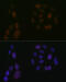 Arachidonate 5-Lipoxygenase antibody, GTX02838, GeneTex, Immunofluorescence image 