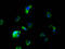 Sodium-iodide symporter antibody, LS-C681382, Lifespan Biosciences, Immunofluorescence image 